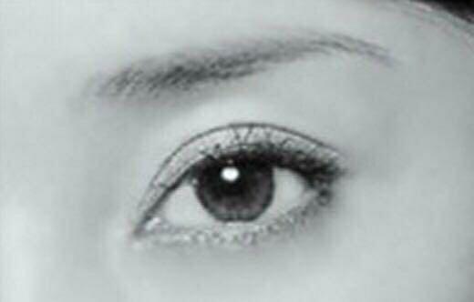 女性双眼皮气质,双眼皮4种形态