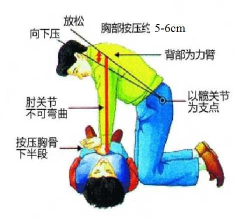 学习心肺复苏操作完整版,急救心肺复苏的7个操作方法