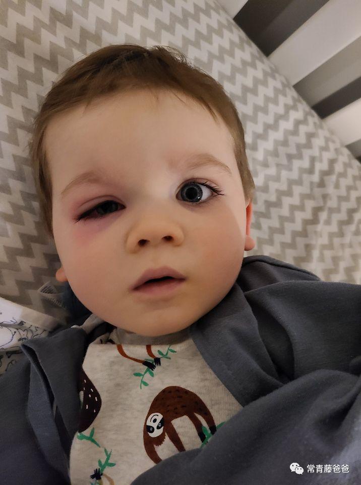 蠢萌蠢萌的洗澡鸭，差点让我儿子失去了一只眼