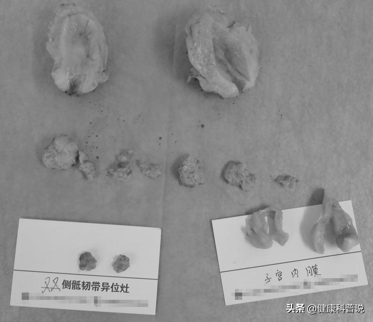 多次检查无法确诊病因的说说,多次检查不出问题是病吗