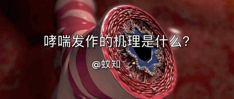 哮喘的发病原理,哮喘科普文章作品简介