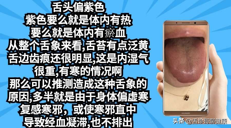 舌诊歌舌象分析与感悟,抖音舌诊哥舌象分析