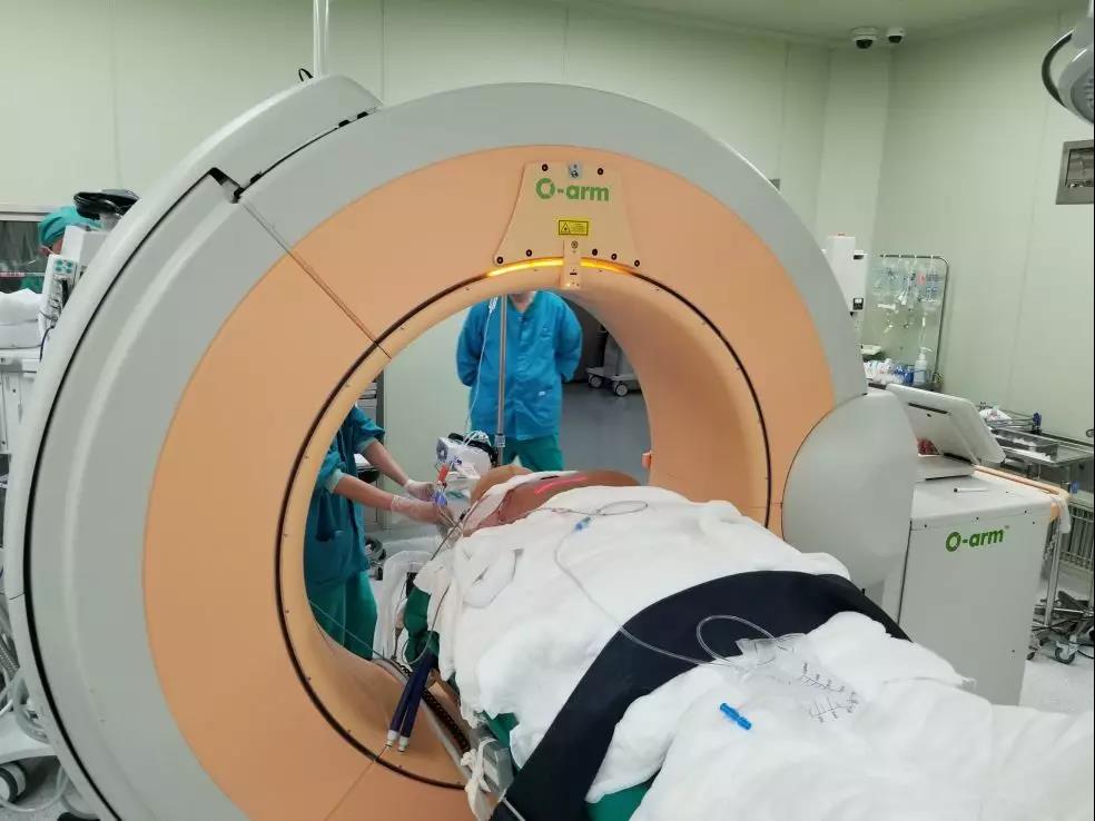 微创脊髓电刺激手术,北京宣武神经外科脊髓电刺激术