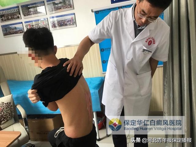 保定华仁白癜风医院是私立的吗,保定华仁白癜风医院免费治疗吗