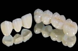 前牙折断修复流程,前牙摔断了咋修复