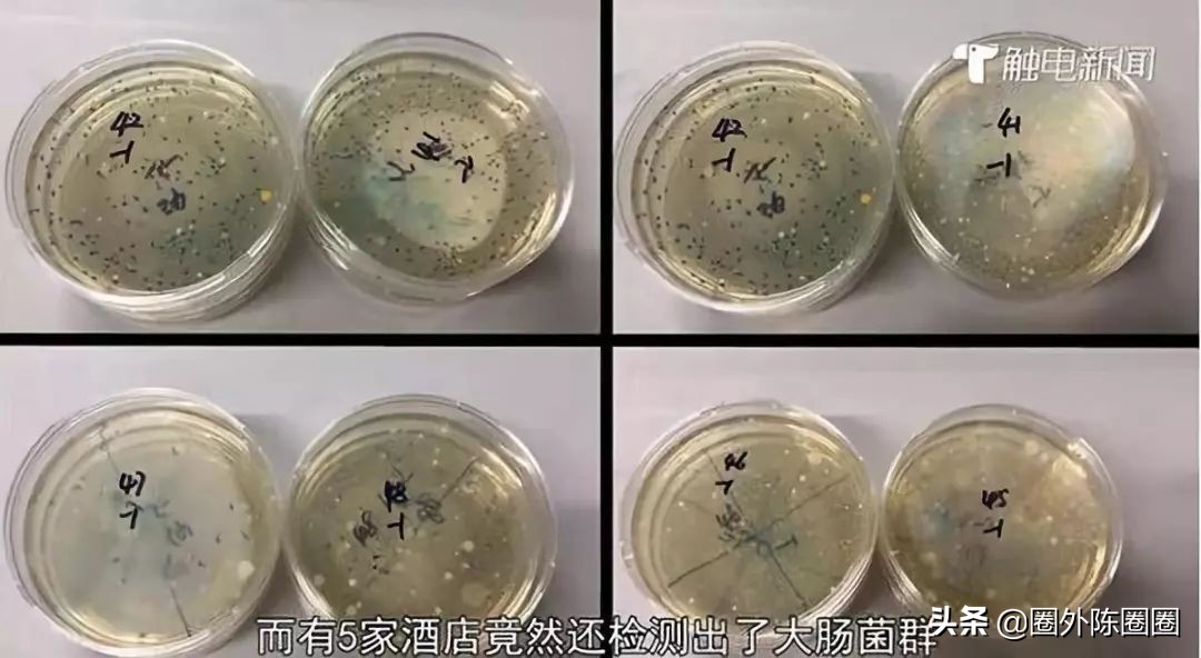 生活中有哪些常见凶险的致病菌,防控病原菌受到污染的措施主要有