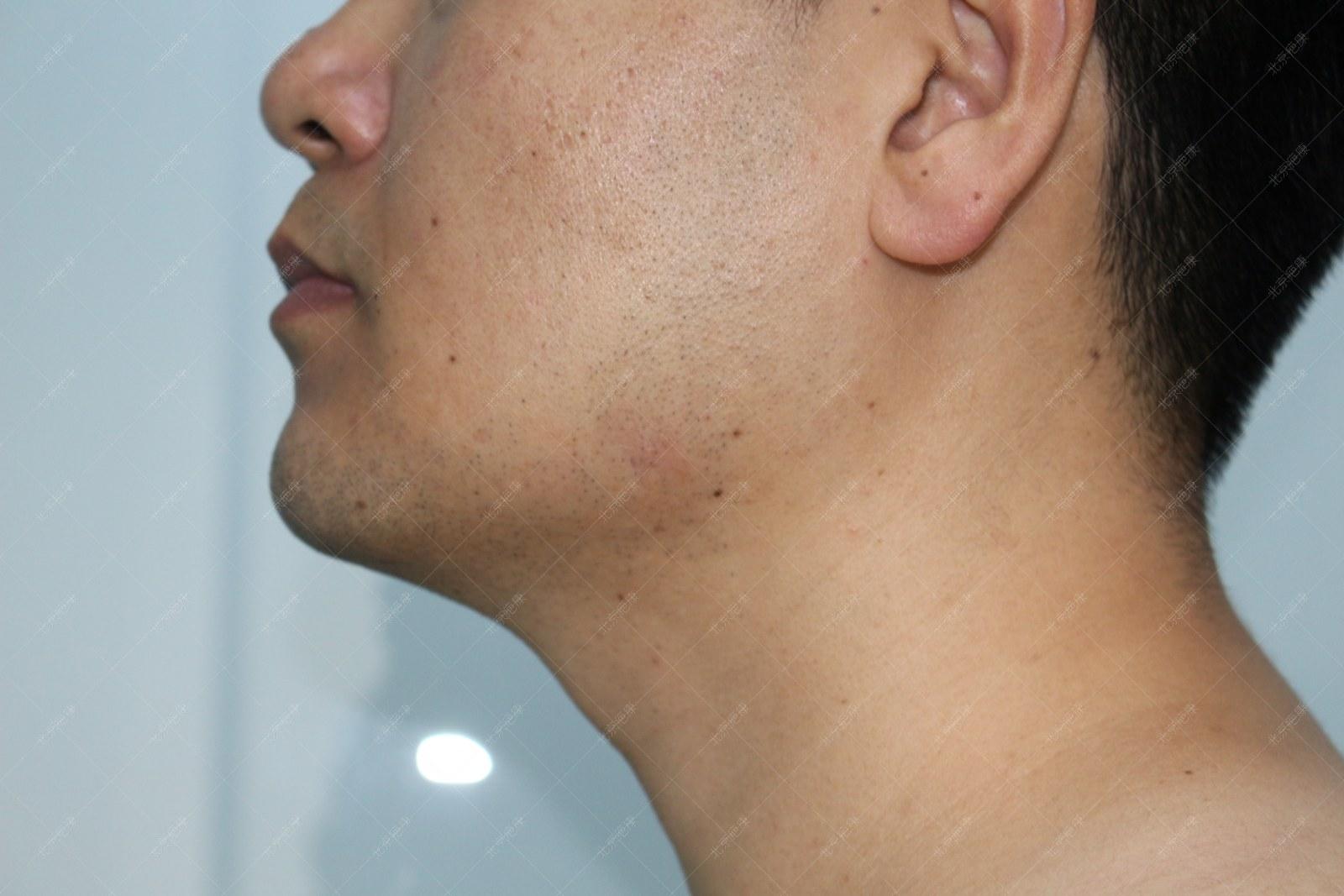 疤康医疗治疤痕疙瘩靠谱吗,乐疤康祛除疤痕有效果吗