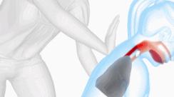 宝宝异物卡喉怎么办,异物卡喉海姆立克急救法多久有效