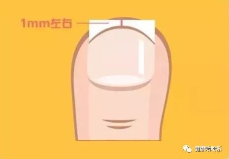 已经做好的指甲怎么修剪,指甲没剪干净搞到肉里了怎么办