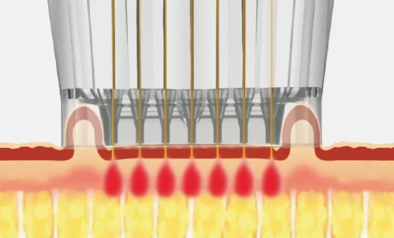 女人的态度取决于男人爱的程度,女人的态度取决于男人爱她的程度