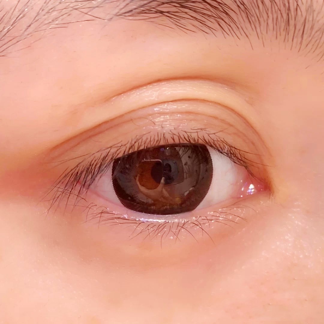 三眼皮显老气吗,三眼皮真的很好看吗