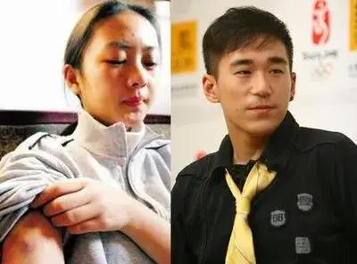 童瑶是张默殴打的人吗,童瑶被张默打是哪一年