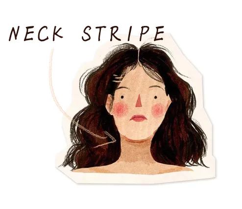 脱毛和祛痘,皮肤脱毛以后要注意什么