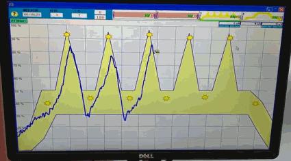 阴道里脱出块“肉”!