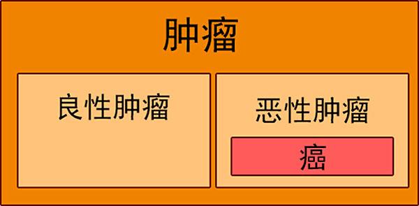 不吃饭能饿死肿瘤细胞吗,饿死的肿瘤怎么处理