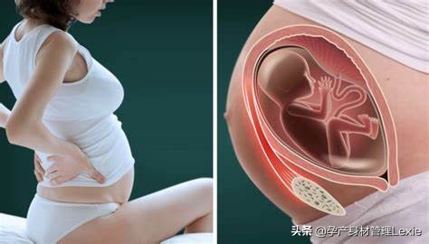 孕期为什么会出现腰痛、下背痛?真相在这里