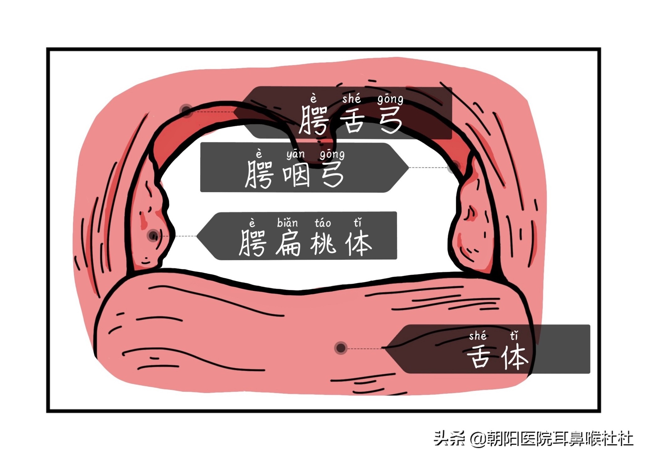 别拿扁桃体发炎不当回事