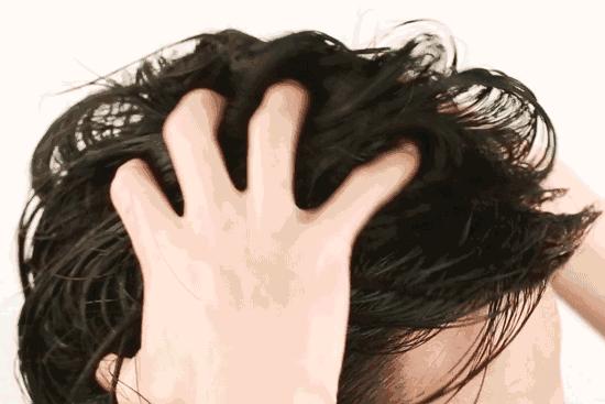 防脱大作战,防脱发不踩雷