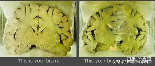 最致命的化学元素是什么,哪些化学物质会对身体有影响