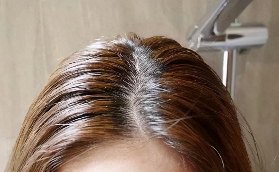 怎么判断是油性头发还是干性头发,怎么知道自己是油性头发还是干性