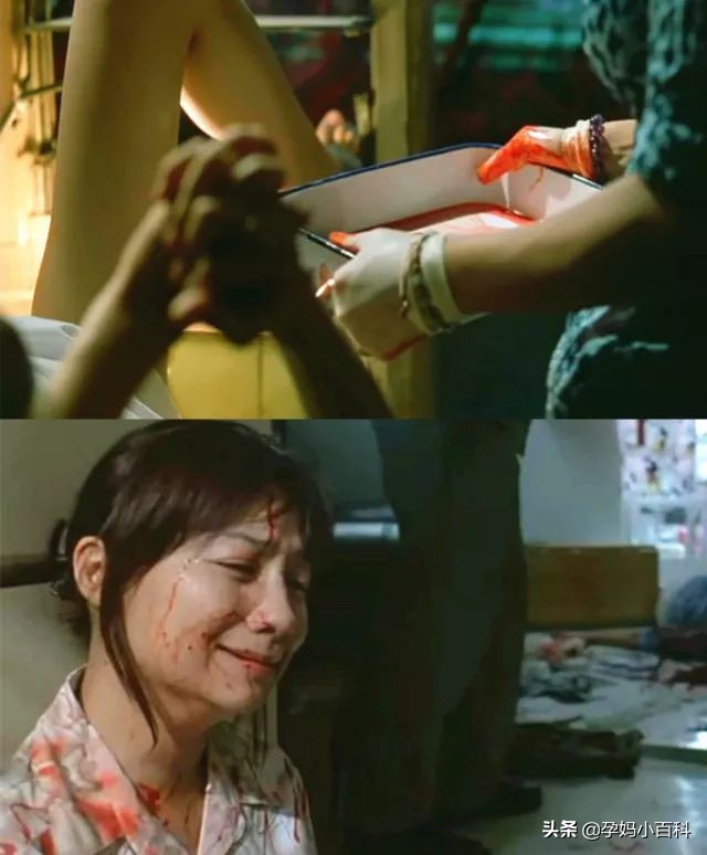 25岁女子做无痛人流,未婚女孩六年做了17次人流