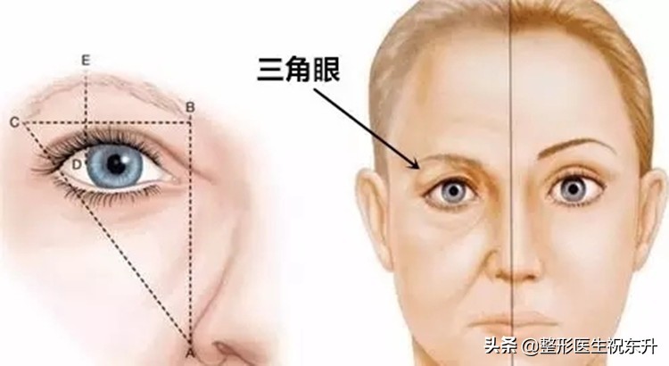 提眉手术害怕不害怕,做提眉手术有什么风险