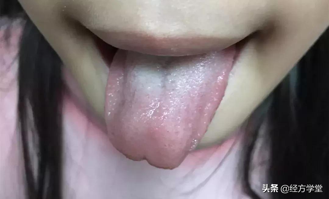 小儿感冒久治不好,小儿感冒反复发烧怎么办