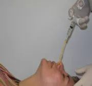 武汉新型肺炎ct检查的出来吗,武汉卫健委谈新型肺炎