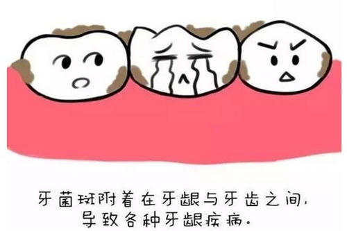 预防牙周病有效的方法,预防牙周病的十种方法