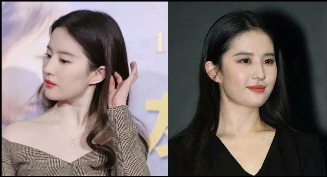 有的人为啥天生就有颈纹,颈纹明显无法掩饰是女神