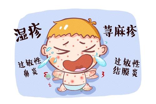 你家宝宝过敏了吗,宝宝是过敏体质怎么护肤