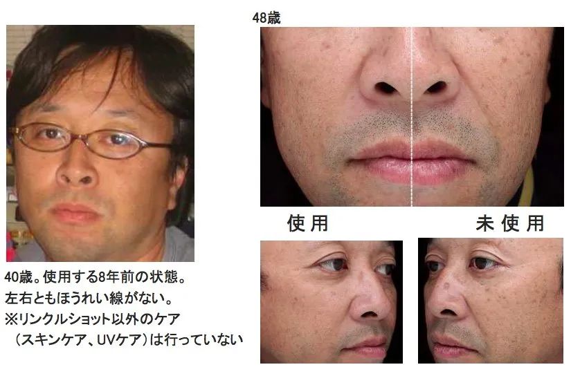 真的神了！抗皱界的最强C位究竟是谁？实验了3个月终于得出了结论