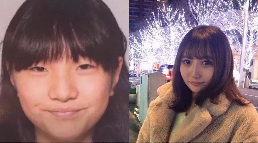 刘梓晨到底有没有整容啊,还记得整容界网红刘梓晨吗