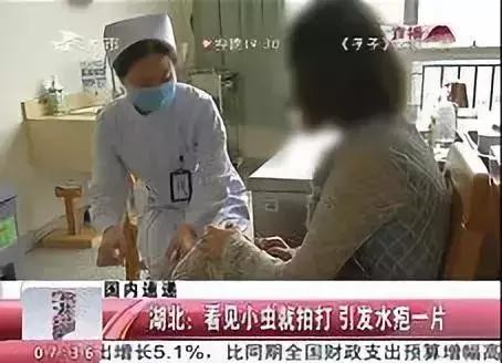 夏天最要小心这四种虫子,在外面遇到这种虫子千万别用手拍