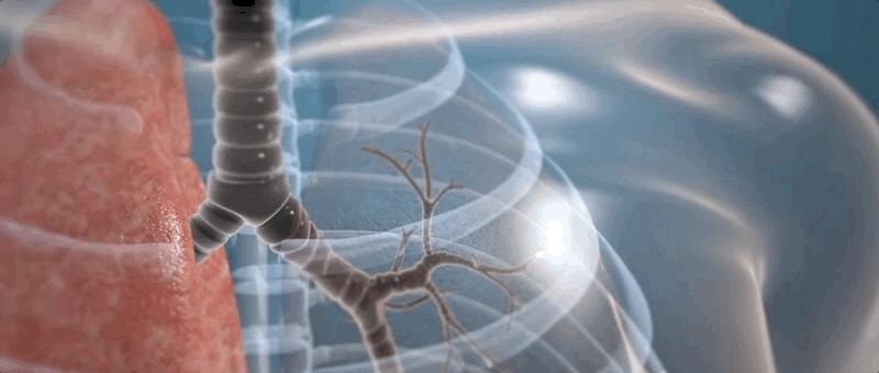 哮喘的发病原理,哮喘科普文章作品简介