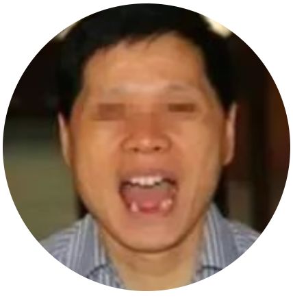 国家有关于牙齿的补贴吗,牙齿补贴报销政策