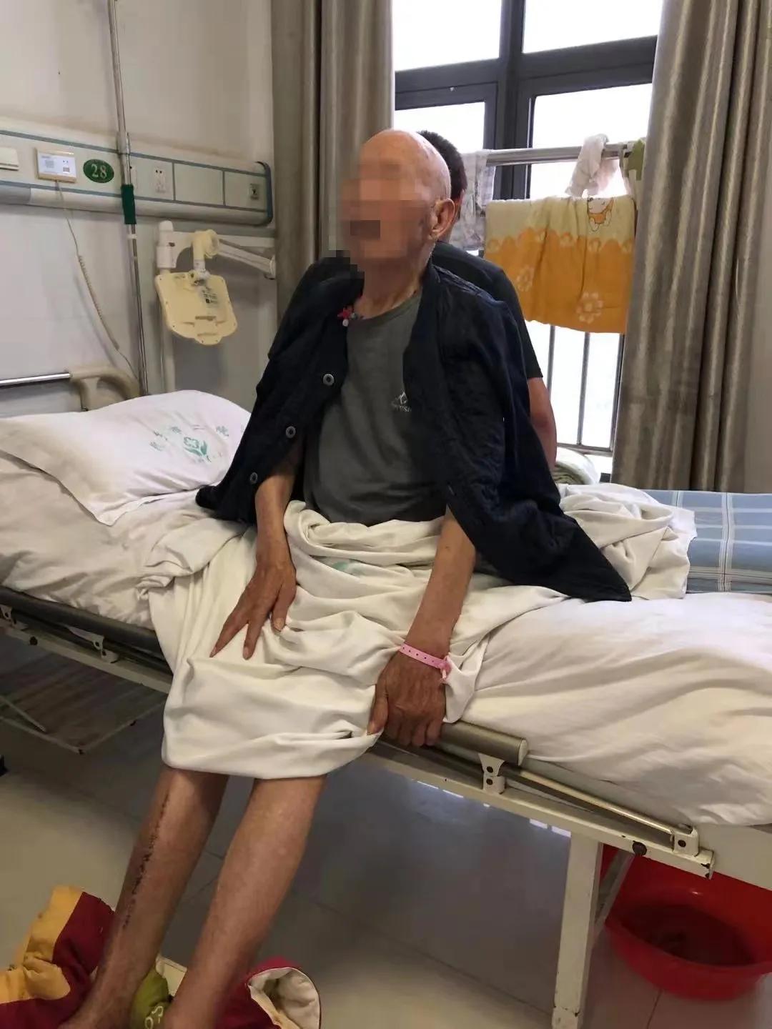 骨折康复科治疗有哪些内容,老人压缩性骨折康复