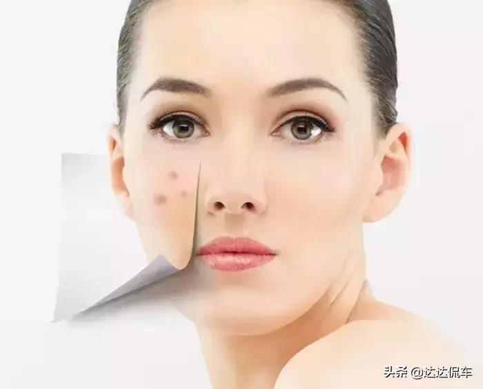 把花露水倒到手机上会怎么样,花露水不小心喷到手机上会怎样