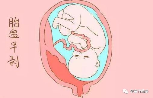 孕期记录孕十三周,孕期指南第6周