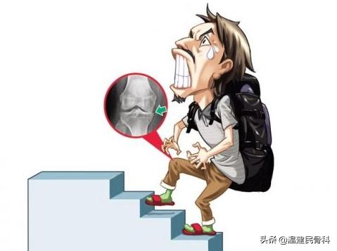 如何诊断膝关节骨性关节炎,膝关节骨性关节炎的判断及治疗