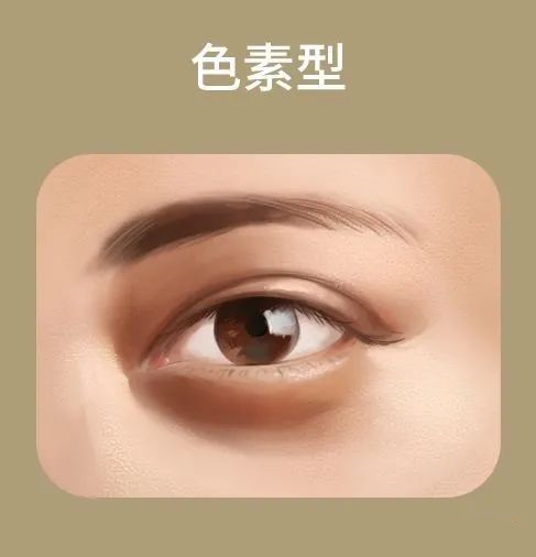 有了黑眼圈怎样改善并注意什么,有黑眼圈怎么才能让黑眼圈下去呢