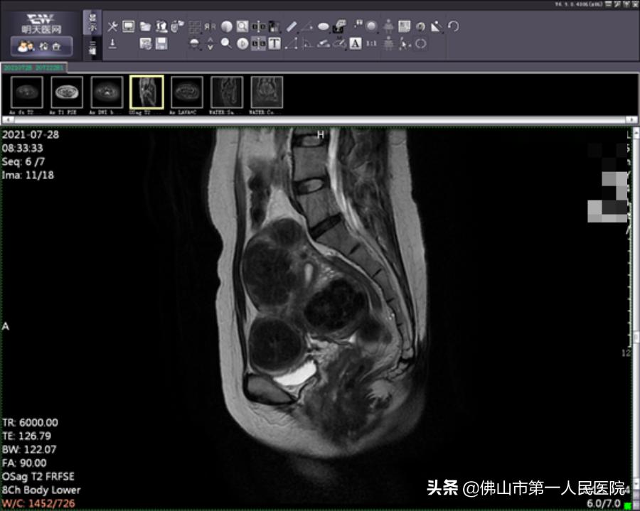 这把“刀”能隔山打“牛”,呵护子宫,带来好“孕”