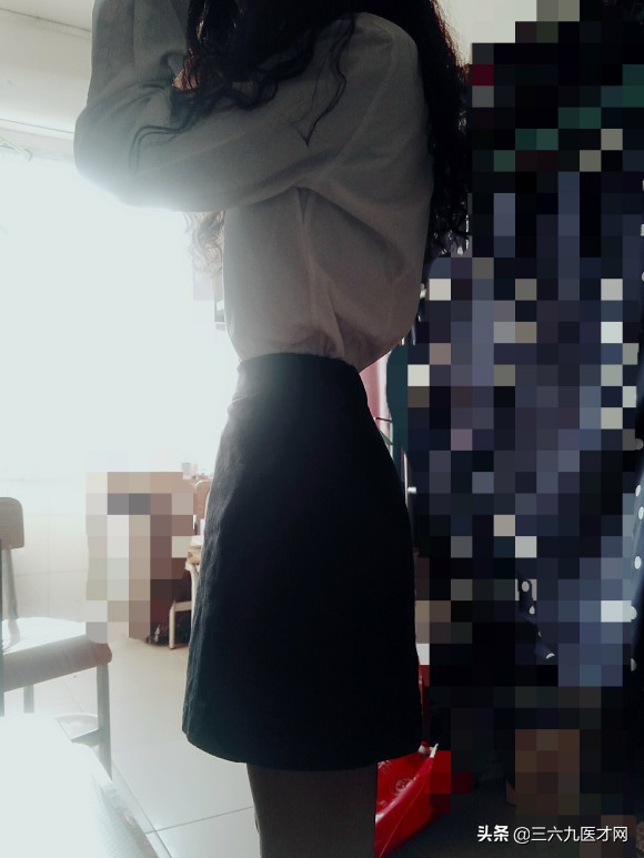 龅牙矫正成功的图片对比,2周岁龅牙可以矫正吗