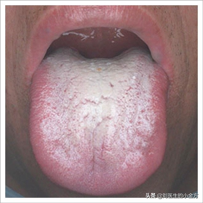 中医舌诊对照表100例,舌诊辨九大体质