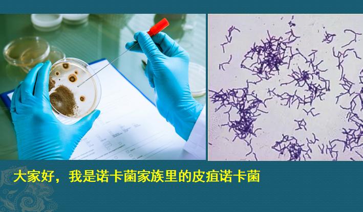 肺诺卡菌感染，当1种分解落叶的细菌，被吸入肺脏