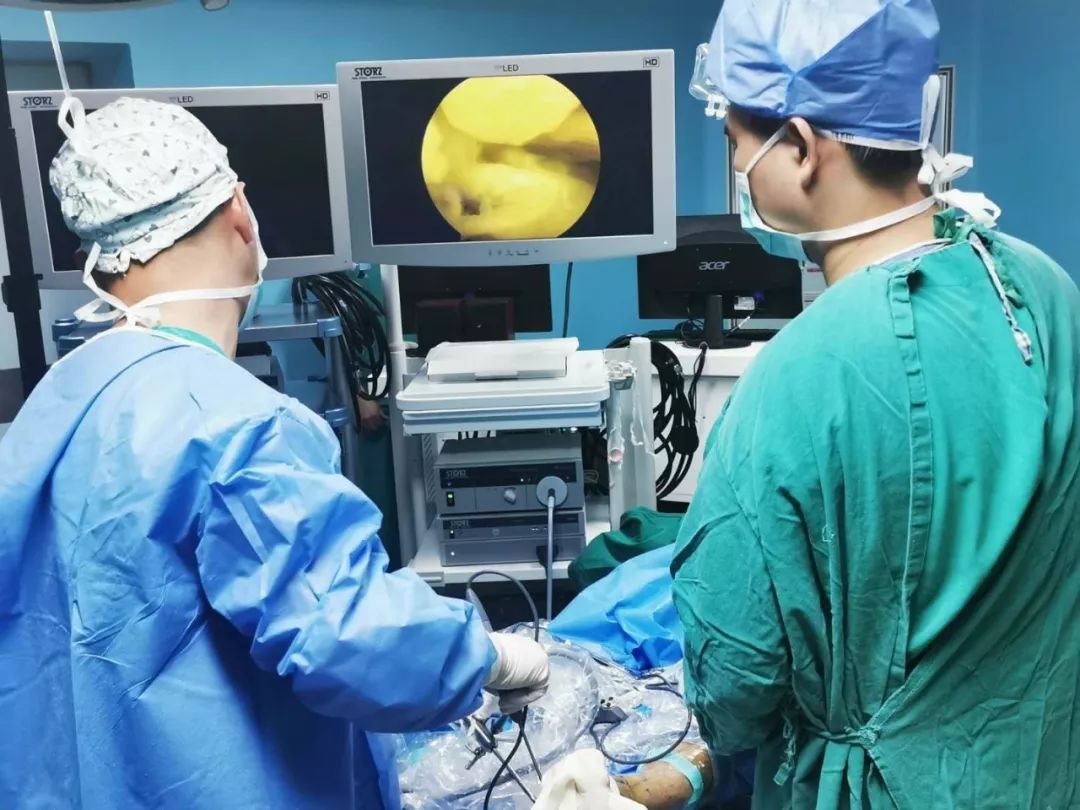 广州天河区中医院骨伤二科成功实施关节镜下跟骨骨刺摘除术