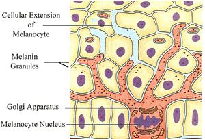 遗传斑祛斑最有效方法,斑怎么祛除最快最有效