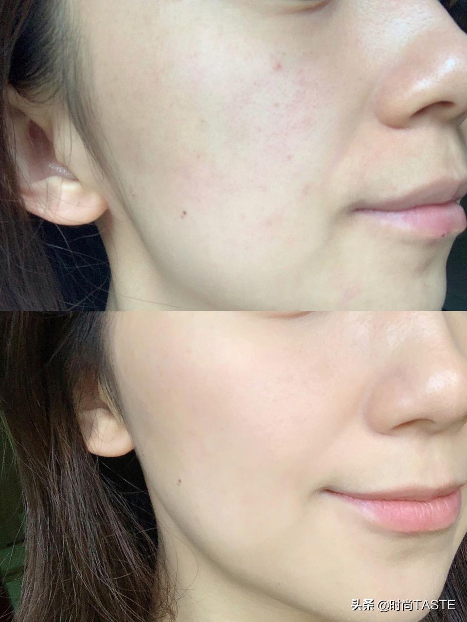 屈臣氏适合敏感肌的面霜,屈臣氏补水保湿面霜推荐