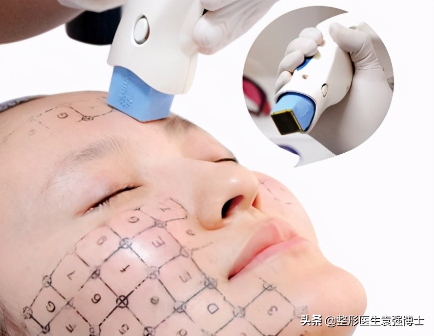 不同年纪应该做哪些医美项目,不同年龄应该选择什么医美项目