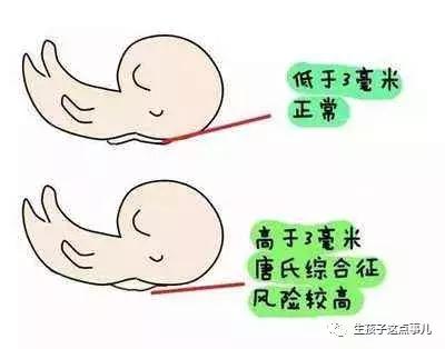 b超上的孕周是按什么来计算的,知道明确受孕日怎么计算孕周